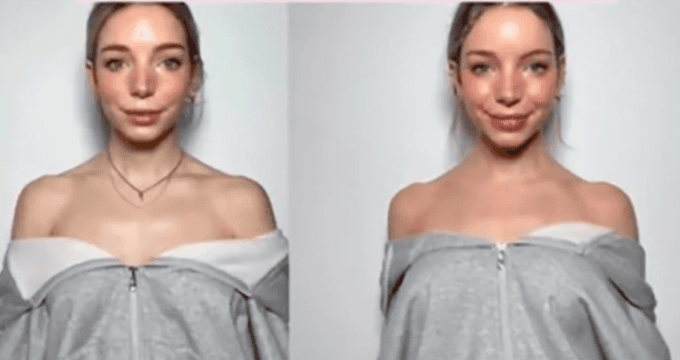 ‘Barbie botox’ is the latest trend that is absolutely sending us