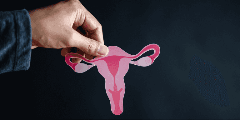 Understanding PCOS: Six mistakes that can worsen your symptoms, according to a GP