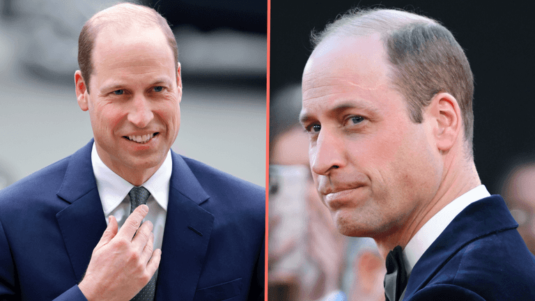 Prince William named sexiest bald man of 2024 Prince William named sexiest bald man of 2024