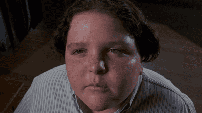 Bruce Bogtrotter star unrecognisable after quitting acting to become a doctor