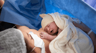 C-Section Mams Ireland