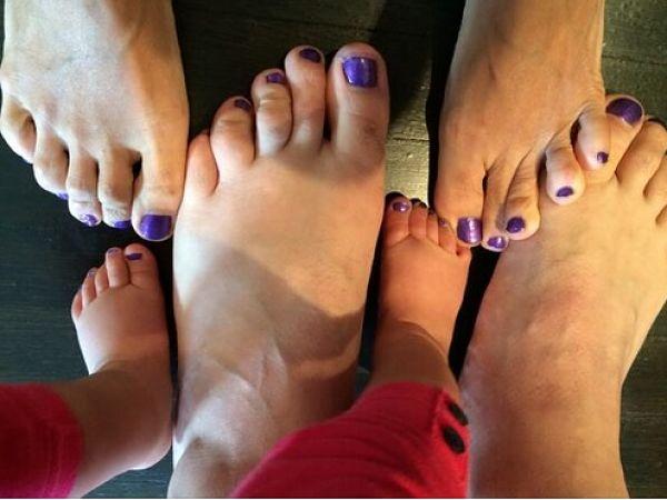 Man Paints His Toenails To Make Wife Smile After Cancer Diagnosis, Hundreds Of People Join In