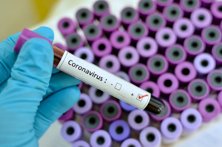 Five new cases of coronavirus confirmed in Ireland as of Friday