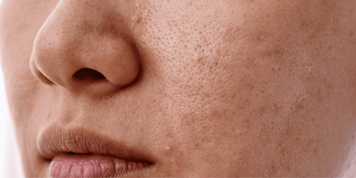 ‘The best anti-ageing tip’ – Dermatologist explains little-known hack