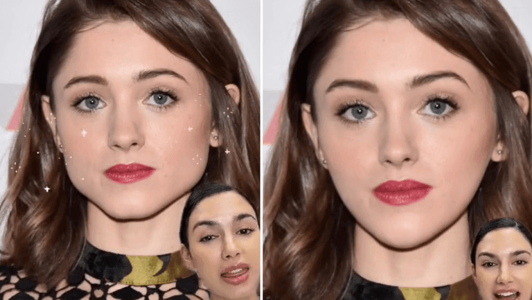 The toxic world of cosmetic surgery TikTok The toxic world of cosmetic surgery TikTok