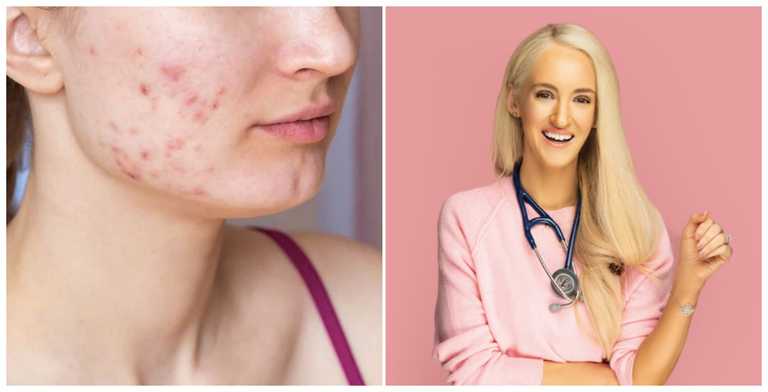 Dr Doireann O’Leary’s top tips on managing acne prone skin and breakouts Dr Doireann O’Leary’s top tips on managing acne prone skin and breakouts