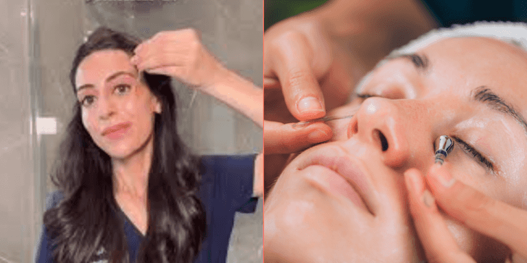 Dermatologist explains how to actually get rid of dark under eye circles Dermatologist explains how to actually get rid of dark under eye circles