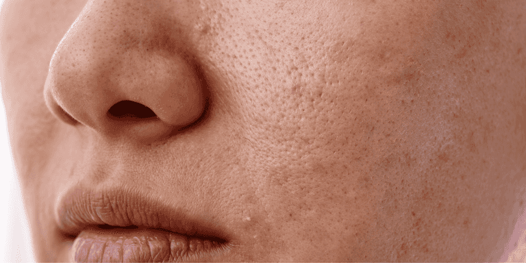 ‘The best anti-ageing tip’ – Dermatologist explains little-known hack ‘The best anti-ageing tip’ – Dermatologist explains little-known hack