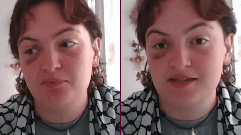 ‘I was beaten by German police at a Palestine march’ ‘I was beaten by German police at a Palestine march’