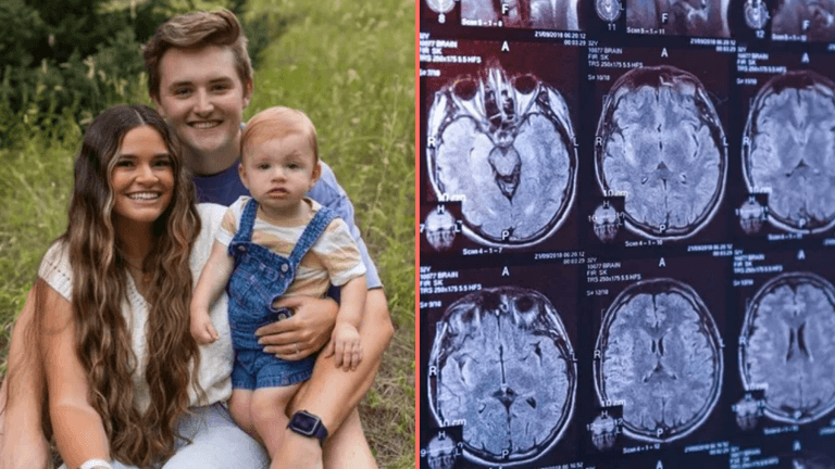 Woman marries man who forgot about their breakup after concussion Woman marries man who forgot about their breakup after concussion